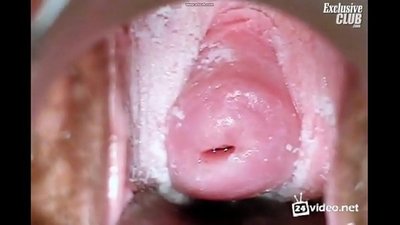 Gynecological nga pagsusi sa usa ka matahum nga babaye